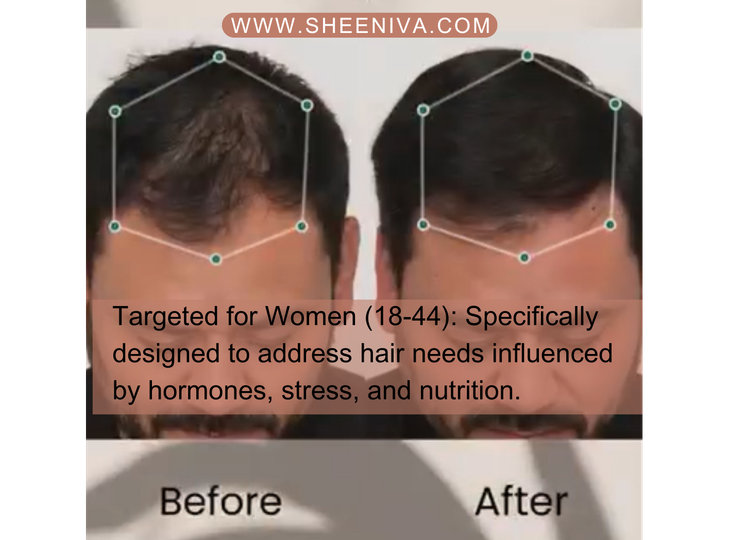 SHEENIVA